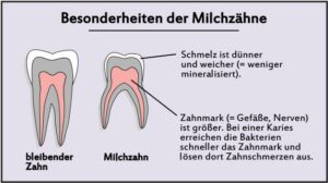 Zahnschmerzen – Haben Kinder Zahnschmerzen?